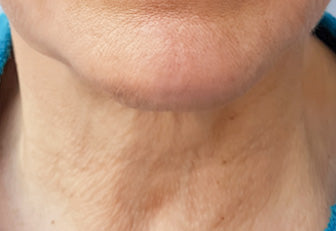 Derma Tech Skin