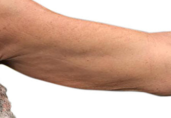 Derma Tech Skin