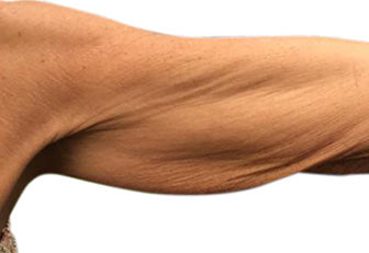 Derma Tech Skin