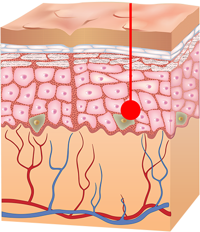 Derma Tech Skin